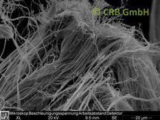 REM-Bild Chrysotil-Asbest in Sokalith | © CRB Analyse Service GmbH
